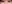 二重まぶた（自然癒着法） — オブジェ美容外科クリニック