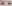 buried suture (non-incisional) double eyelid surgery — Wivers Plastic Surgery Clinic