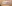 唇のヒアルロン酸注入（リップヒアルロン酸） — ロリポップ美容外科クリニック