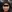 リジュランS（サーモン注射・PN注射） — 一空公美容外科クリニック