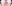 団子鼻修正（鼻尖縮小術） — アウラ美容外科クリニック