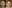 豊胸術（シリコンインプラント／人工乳腺） — キリン美容外科クリニック
